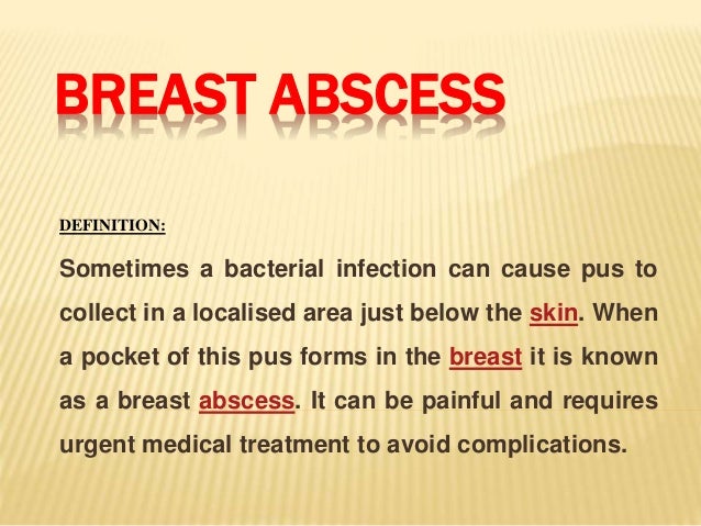 treatment of breast abscess Treatment of breast abscess